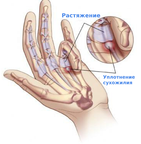 Осмотр пациента со щёлкающим пальцем (болезнь Нотта) в клинике