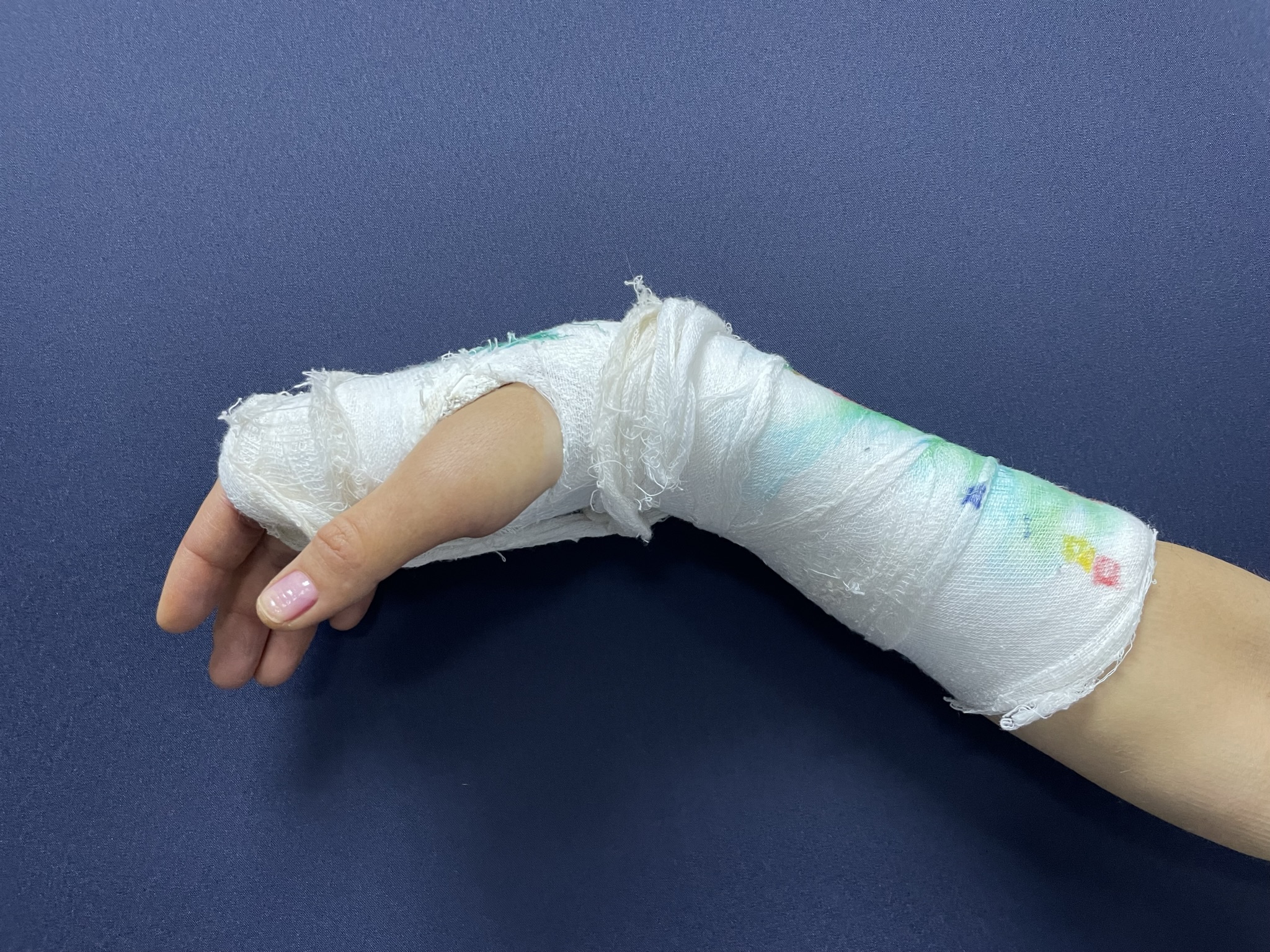 Ортезотерапия: контроль, снимок 1