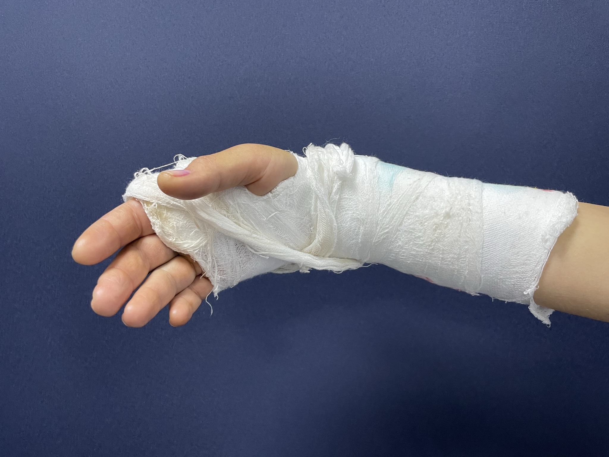 Ортезотерапия: контроль, снимок 3