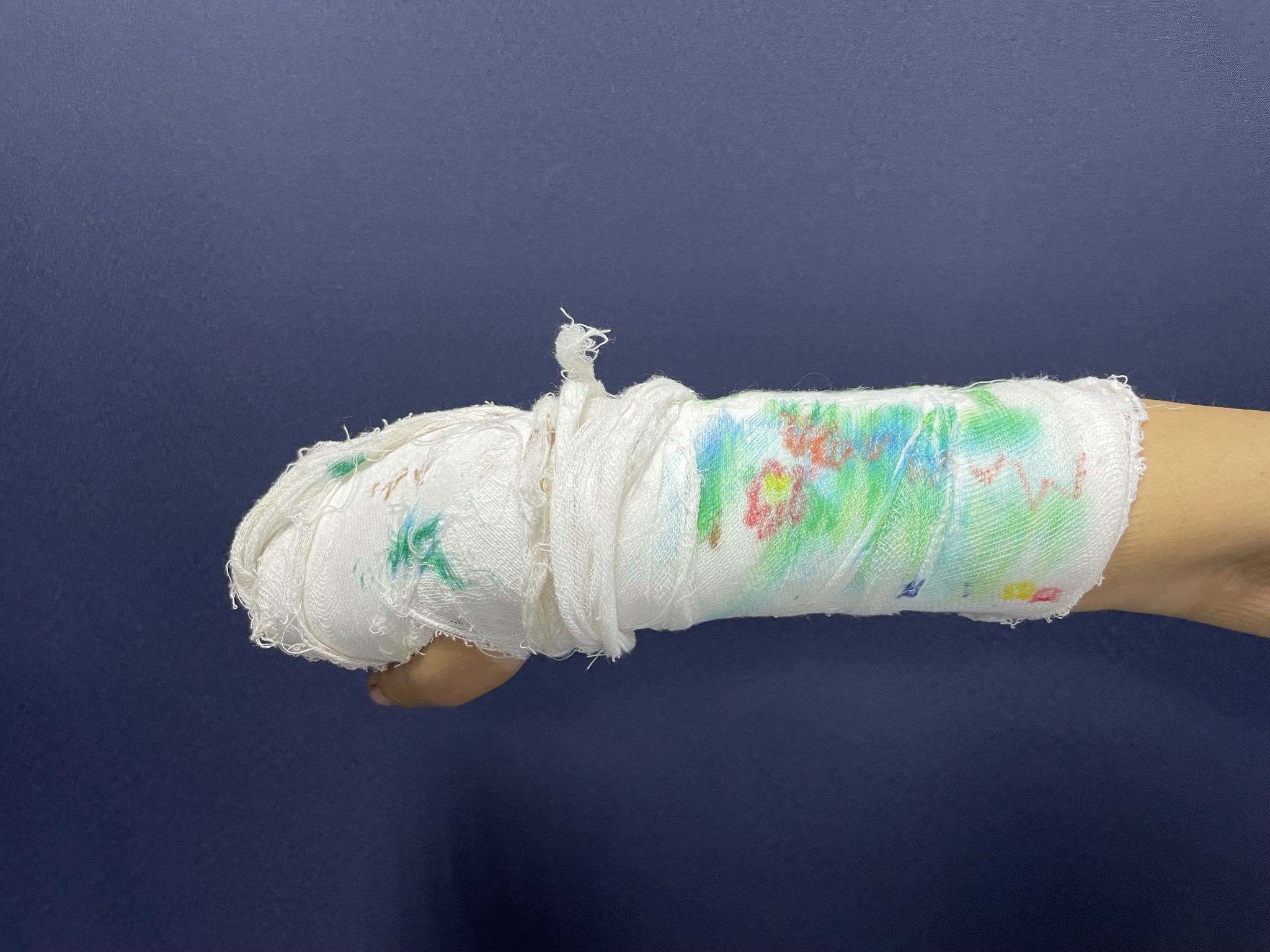 Ортезотерапия: контроль, снимок 4