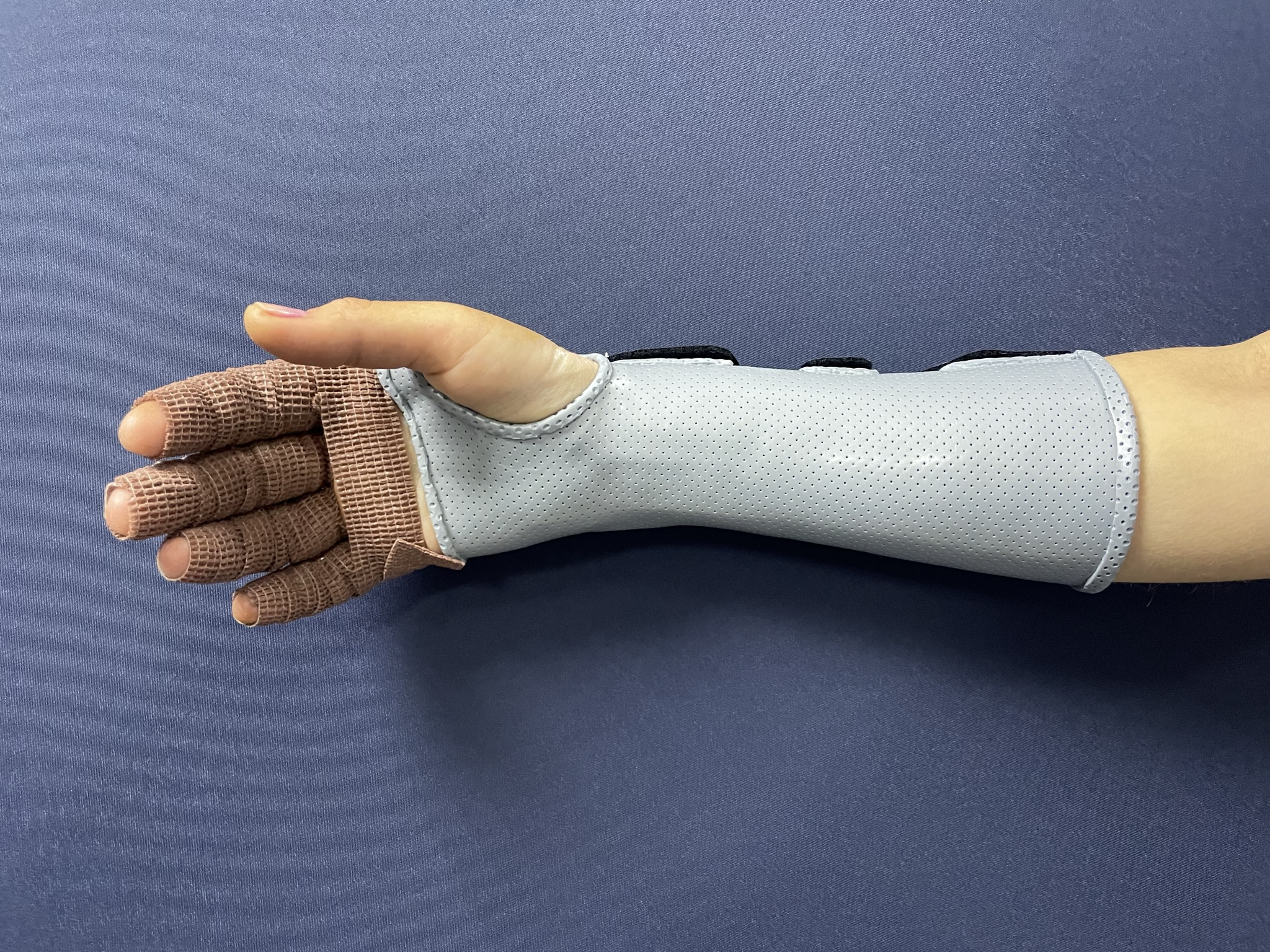 Ортезотерапия: контроль, снимок 5