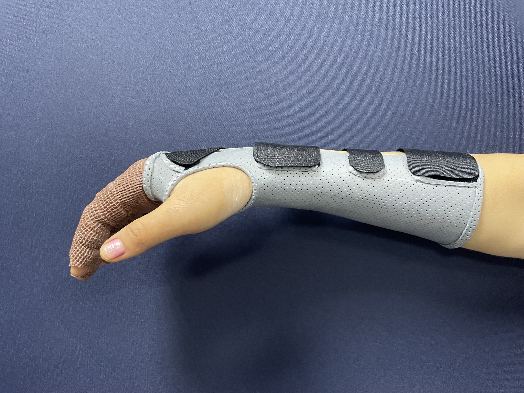 Ортезотерапия: контроль, снимок 6