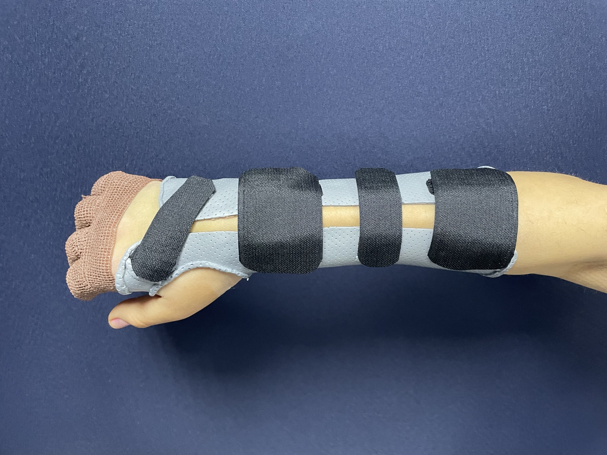 Ортезотерапия: контроль, снимок 7