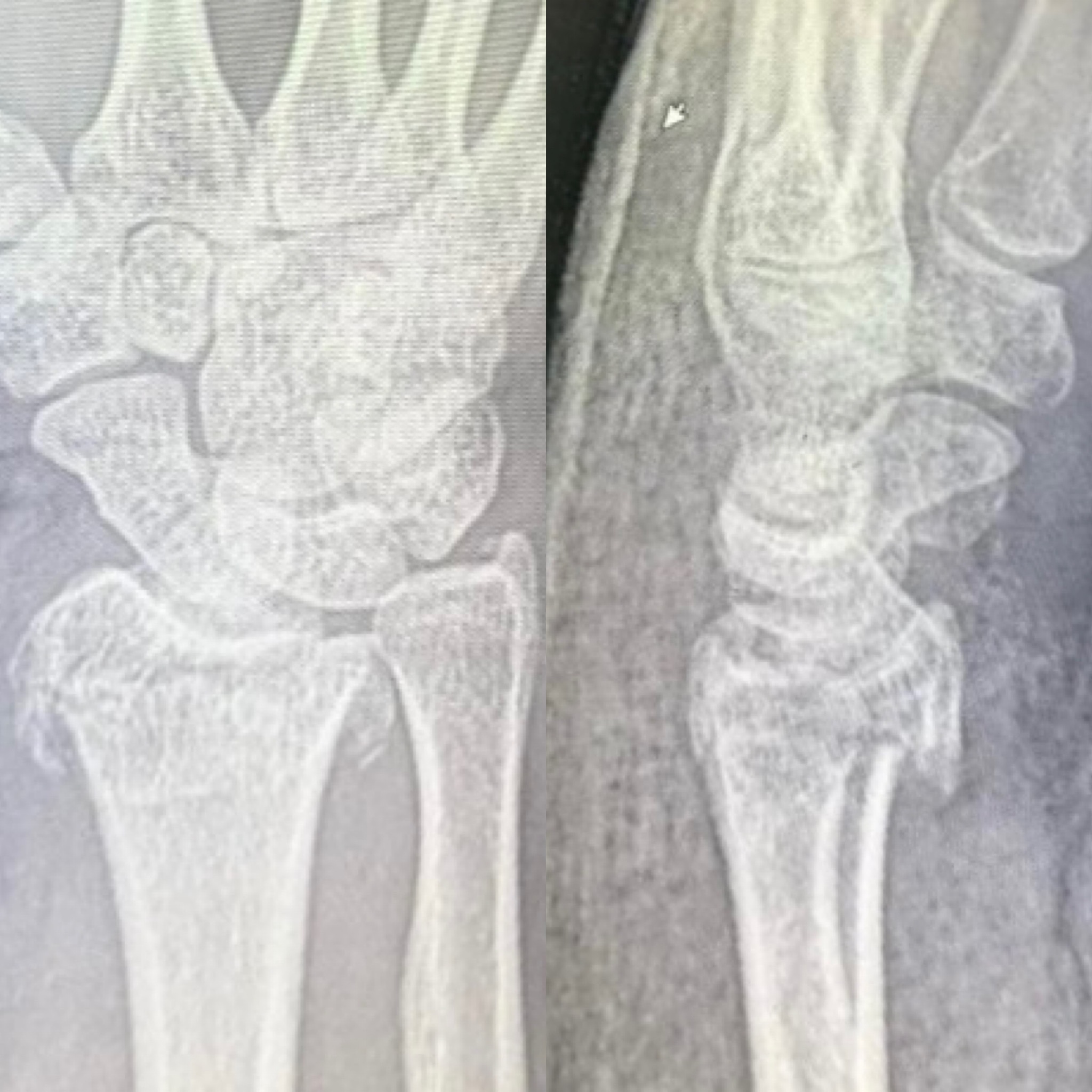 До операции: клинический осмотр, снимок 1