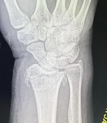 До операции: клинический осмотр, снимок 2