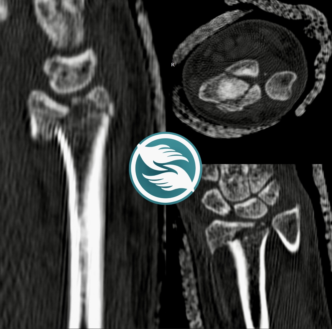 До операции: клинический осмотр, снимок 3