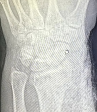 До операции: клинический осмотр, снимок 4