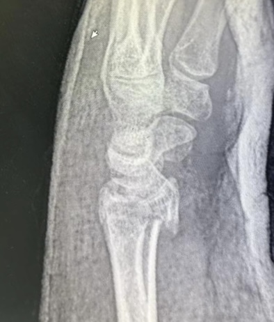 До операции: клинический осмотр, снимок 5